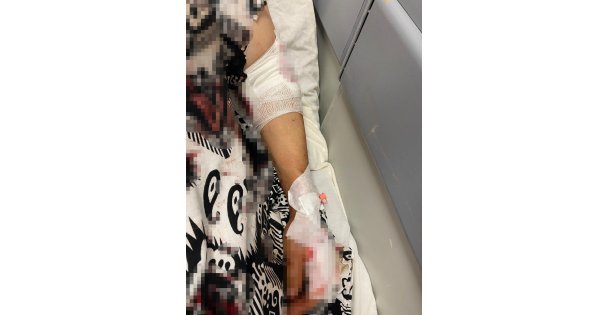 Abdest almak için bahçeye çıkan kadına köpekler saldırdı