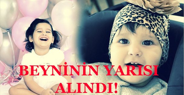 BEYNİNİN YARISI ALINDI!