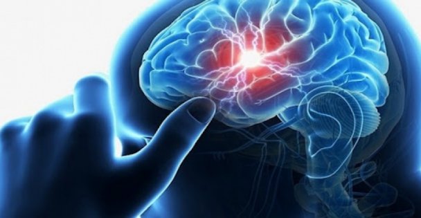 Her Bir Dakikada Bir Kişi İnme Geçiriyor!